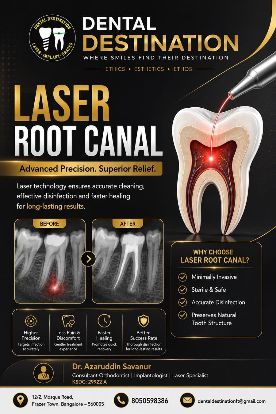 Root Canal Treatment